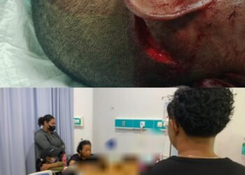 Polres Mimika Ungkap Kronologi Pembacokan di Jalan Perintis, Korban Masih Dirawat
