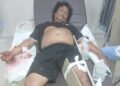 Bentrok Pendulang Emas di Mile 21 Mimika, Polisi Tegaskan Bukan Konflik Antarsuku